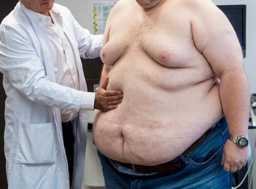 Слишком жирно — терять триллионы рублей из-за не в меру упитанных сограждан