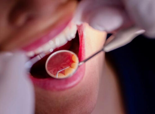 Ученые придумали, как заставить бормашину перестать пугать пациентов